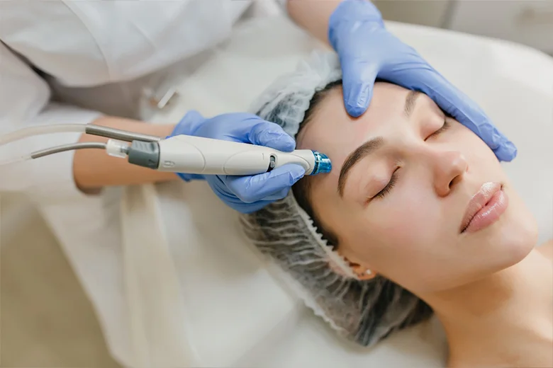 Gesichtsbehandlung Microdermabrasion waiblingen